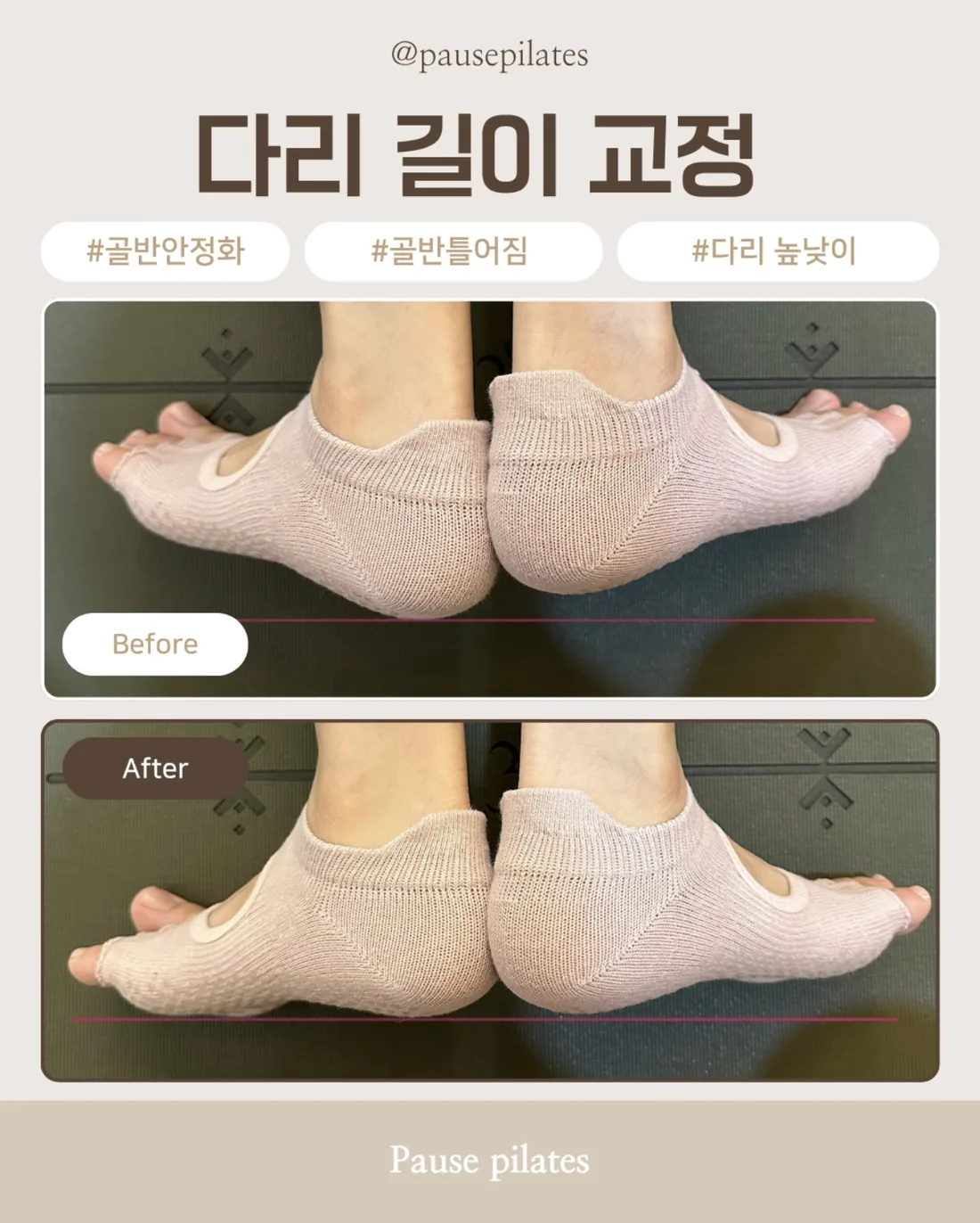 포즈필라테스 비포애프터 다리 길이 교정