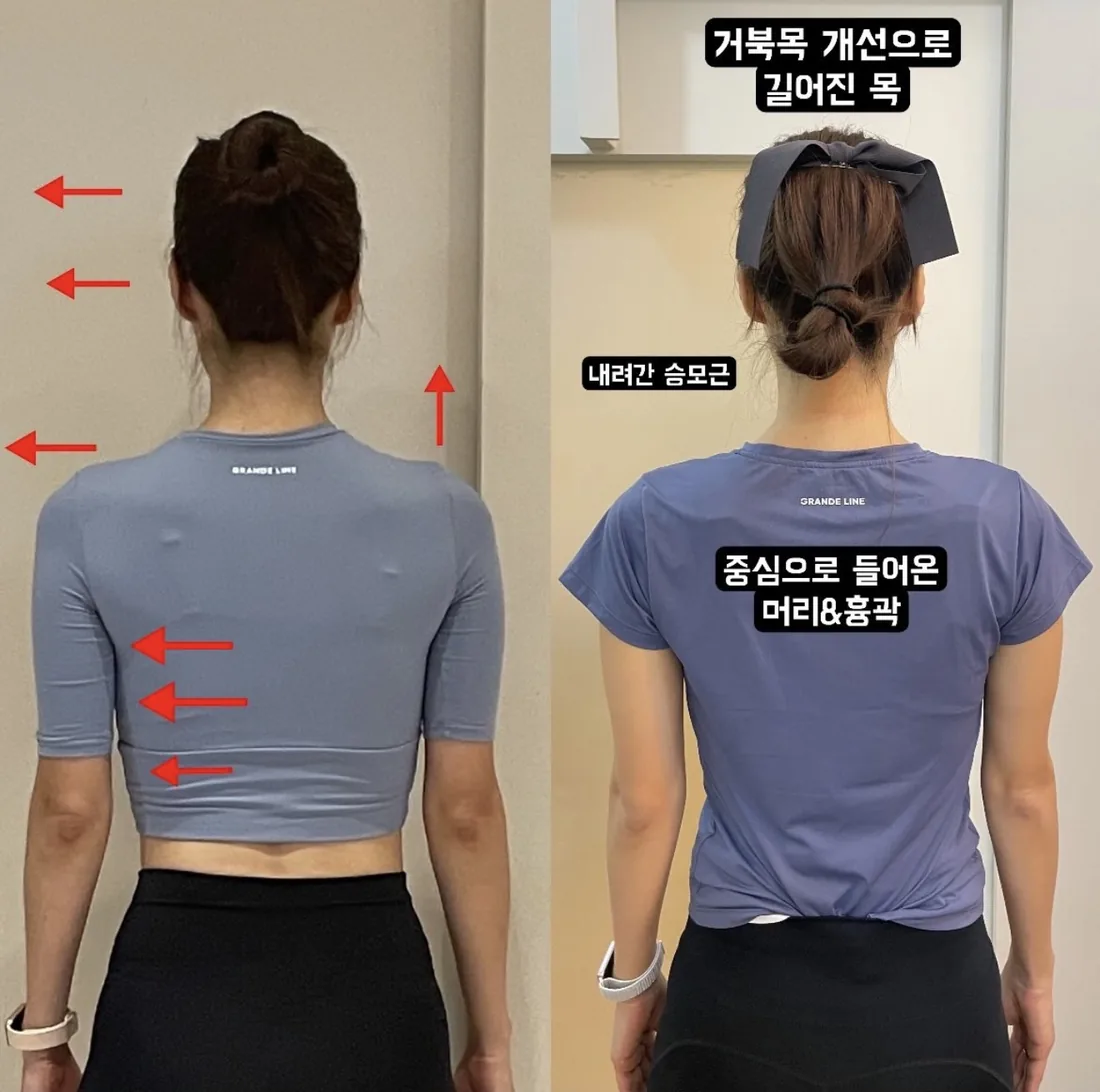 [중곡역필라테스] 거북목, 굽은 어깨… 하루 종일 앉아 있다면 자세부터 봐요