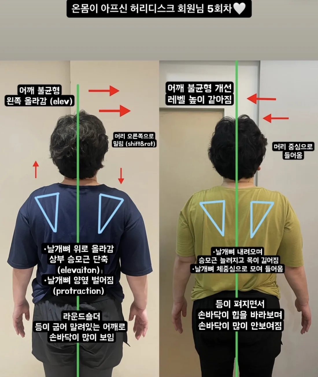 [중곡역필라테스] 허리디스크·골반 통증, 운동이 무서운 분이라면