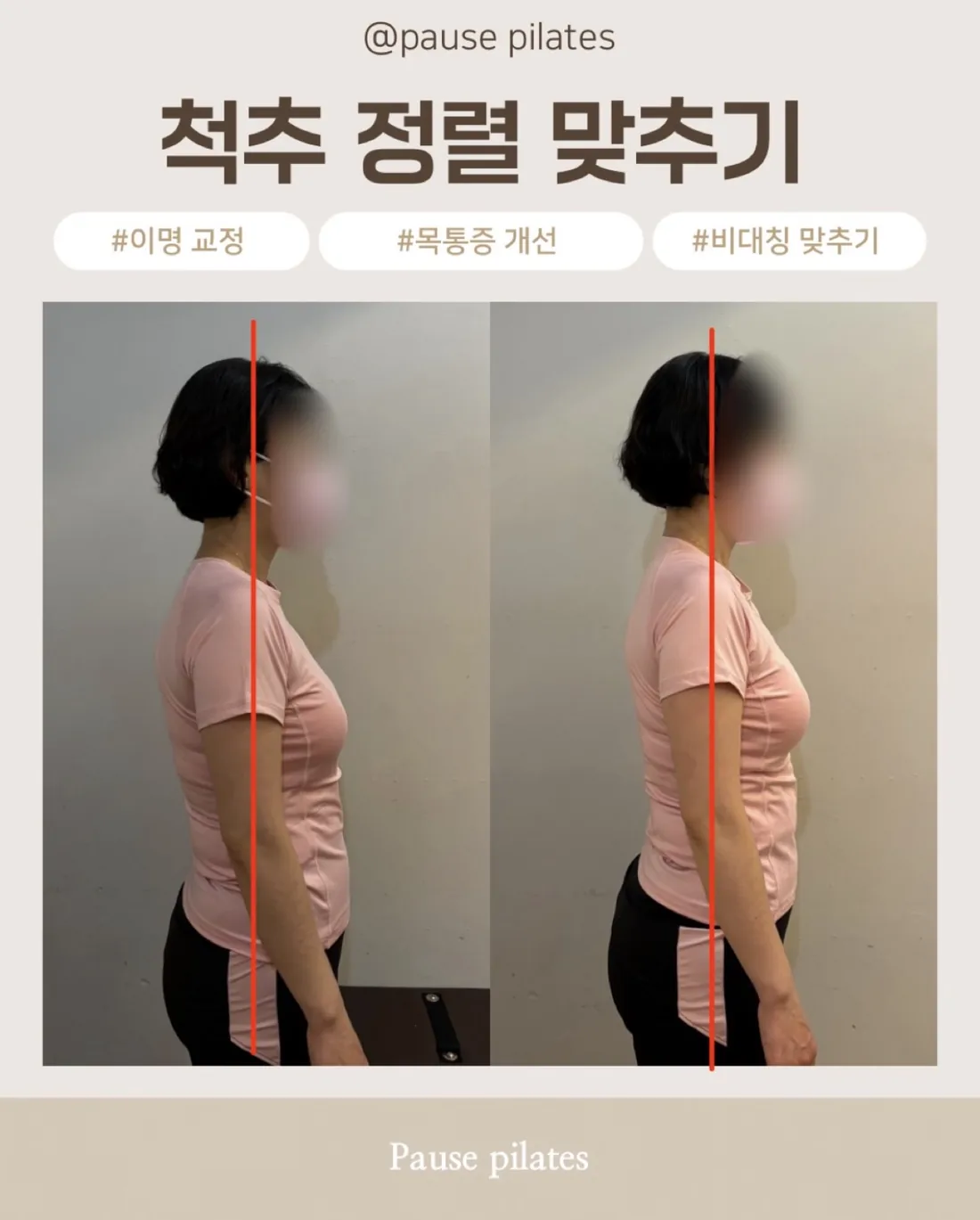 포즈필라테스 비포애프터 척추 정렬 목통증