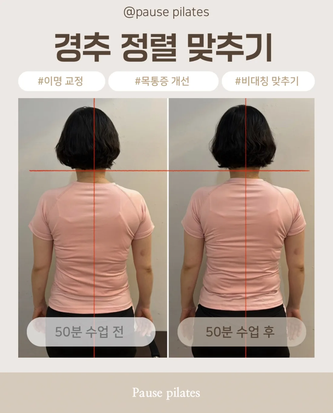 포즈필라테스 비포애프터 경추 정렬 50분 수업 전후